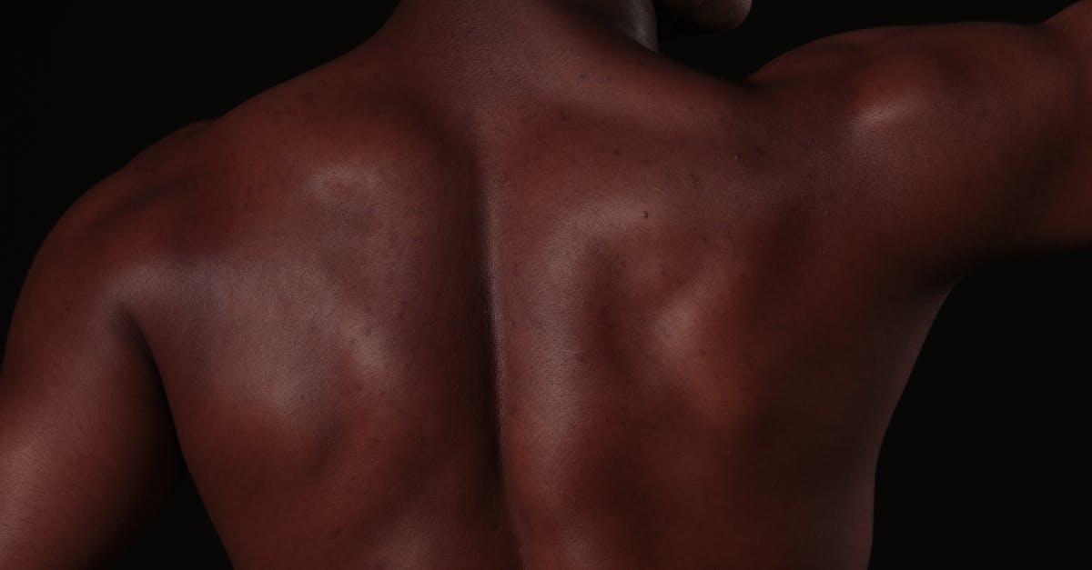 discover effective strategies and treatments for upper back stiffness. learn about the causes, symptoms, and how to alleviate discomfort to improve your mobility and overall well-being.