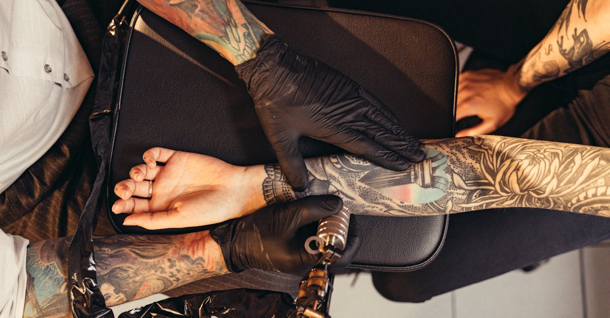 discover effective solutions and insights for managing arm pain. explore common causes, treatment options, and preventive measures to relieve discomfort and enhance mobility.