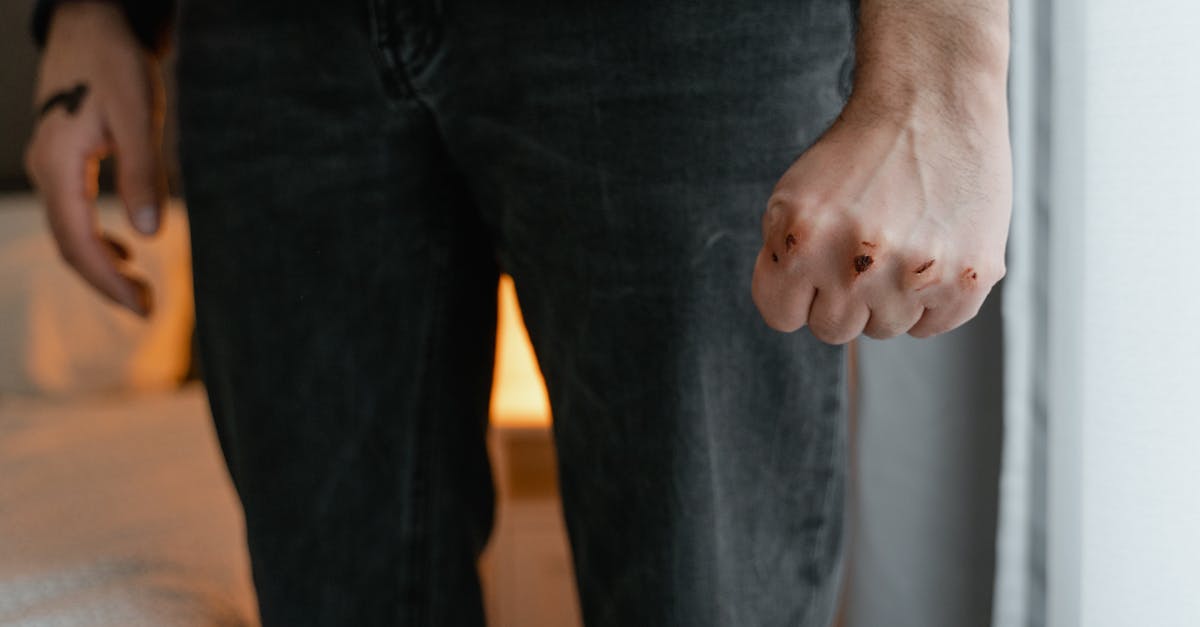 discover effective tips and treatments for arm pain relief. explore causes, symptoms, and therapies to help you regain mobility and comfort.