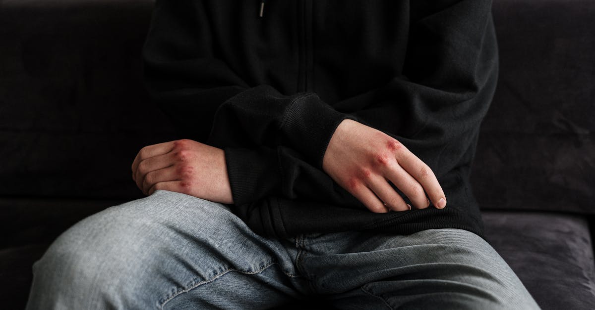 learn about brachial plexus injuries, including causes, symptoms, diagnosis, and treatment options. discover how these injuries affect the nerves and muscles of the arm and shoulder, as well as potential recovery paths and rehabilitation strategies.