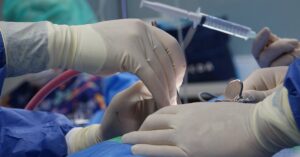 learn about herniated discs, their causes, symptoms, treatment options, and prevention tips. discover how to manage pain and improve your quality of life.