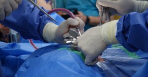 discover the causes, symptoms, and treatment options for spinal stenosis, a condition that constricts the spinal canal, leading to pain and mobility issues. learn how to manage your health and improve your quality of life.