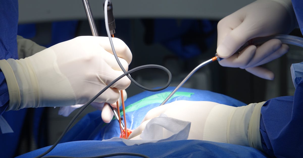 learn about spinal stenosis, a condition characterized by the narrowing of the spinal canal, which can lead to pain and nerve issues. discover its causes, symptoms, and effective treatment options to effectively manage your health.