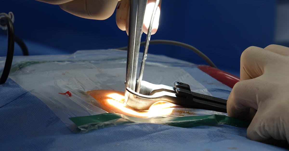 discover comprehensive insights about spinal stenosis, its symptoms, causes, diagnosis, and effective treatment options. learn how to manage and alleviate the discomfort caused by this condition for a healthier, pain-free life.