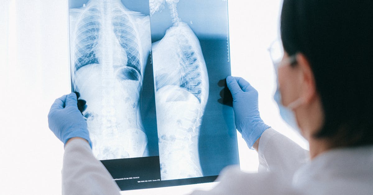 explore the causes, symptoms, and treatment options for thoracic spine pain. learn how to manage discomfort and improve your quality of life with effective strategies designed to relieve pain in the thoracic region.