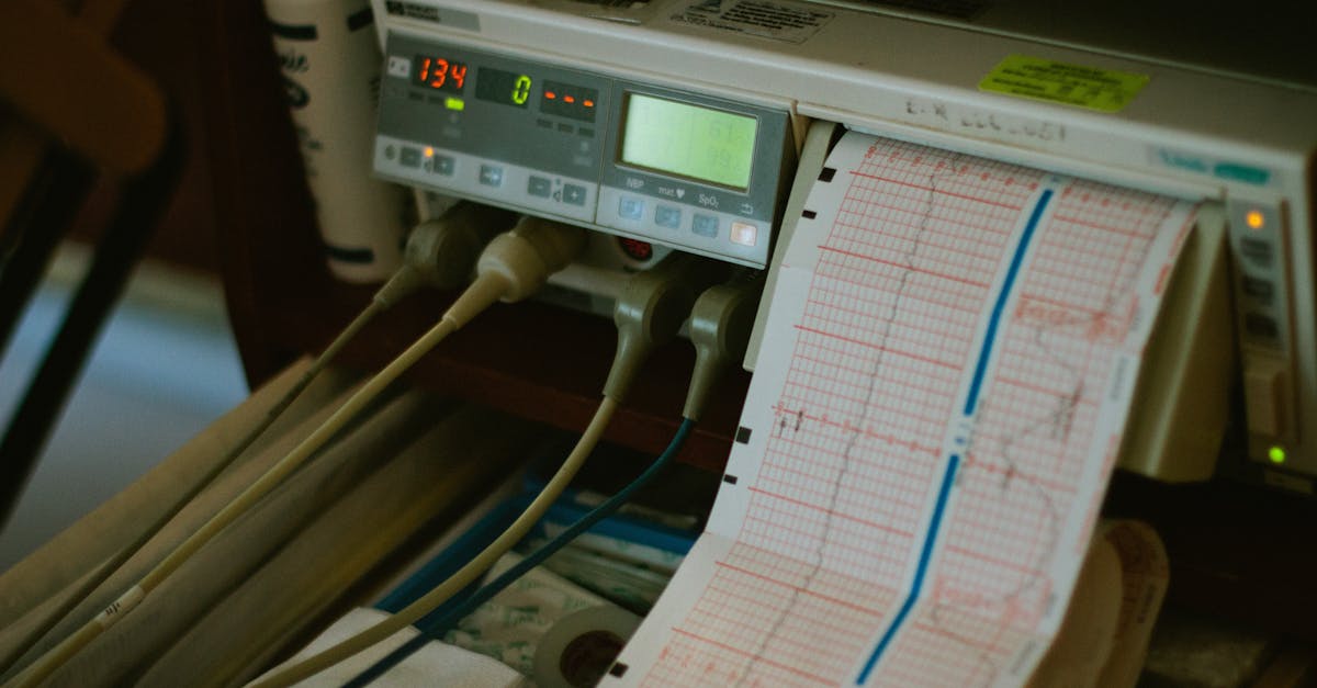 explore the innovative techniques of pulse alignment, a method that enhances precision in synchronous operations. discover how pulse alignment can optimize performance in various applications, from telecommunications to signal processing, ensuring better accuracy and efficiency.