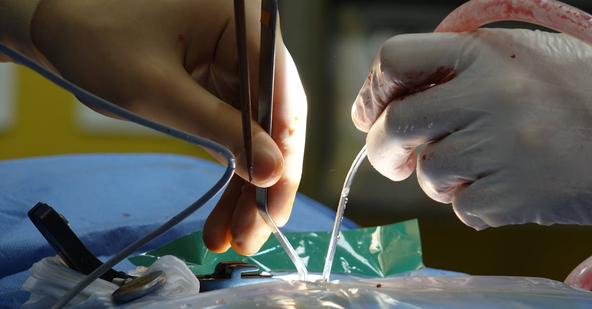 discover comprehensive insights on herniated disc, including symptoms, causes, treatment options, and preventive measures. learn how to manage pain and improve your quality of life with expert advice and resources.