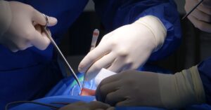 learn about spinal stenosis, a condition characterized by the narrowing of the spinal canal that can cause pain, numbness, and mobility issues. explore symptoms, causes, treatment options, and tips for managing this condition effectively.