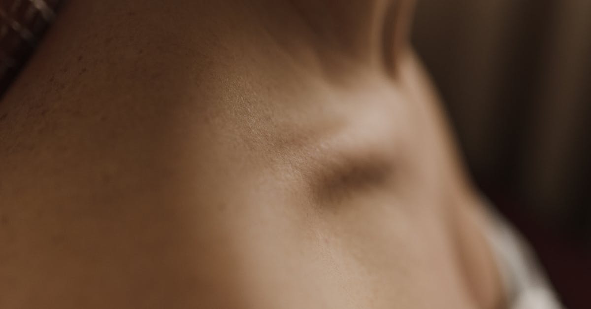learn about shoulder bursitis, its common causes, symptoms, and treatment options. discover how to relieve pain and improve mobility with expert tips and effective therapies.