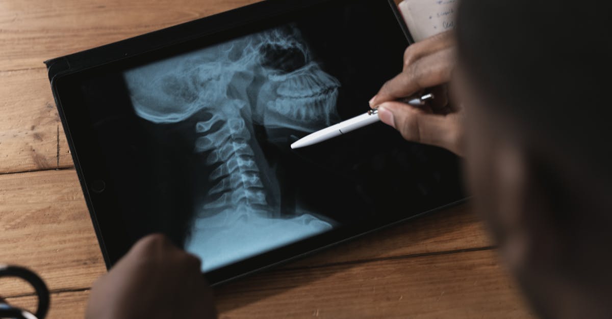 discover the causes, symptoms, and effective solutions for tech neck. learn how to prevent neck pain and improve your posture while using digital devices.
