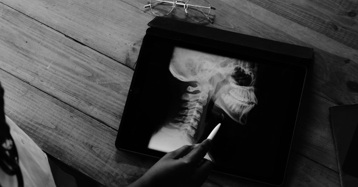 discover what tech neck is, its common symptoms, causes from prolonged device use, and effective tips to prevent and relieve neck pain associated with modern technology habits.